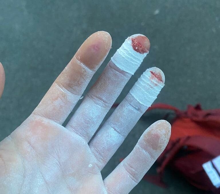 Taping for climbing: How to tape your fingers the right way