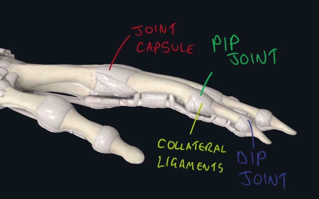 Climbing synovitis and joint swelling: How to beat it